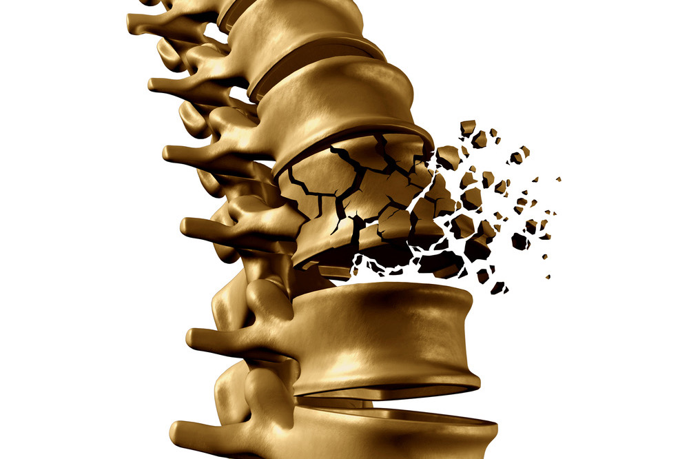 Vertebral Compression Fracture